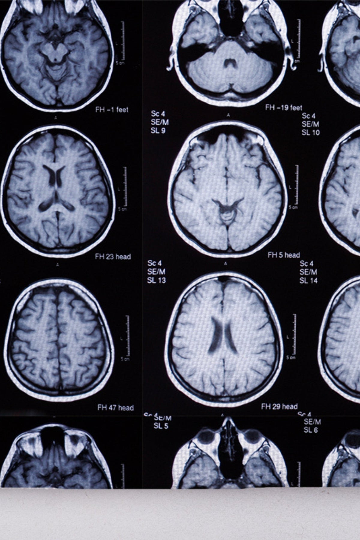 Reeks hersen-MRI's voor medische muts van Aelin – unieke motieven geïnspireerd door Grey’s Anatomy